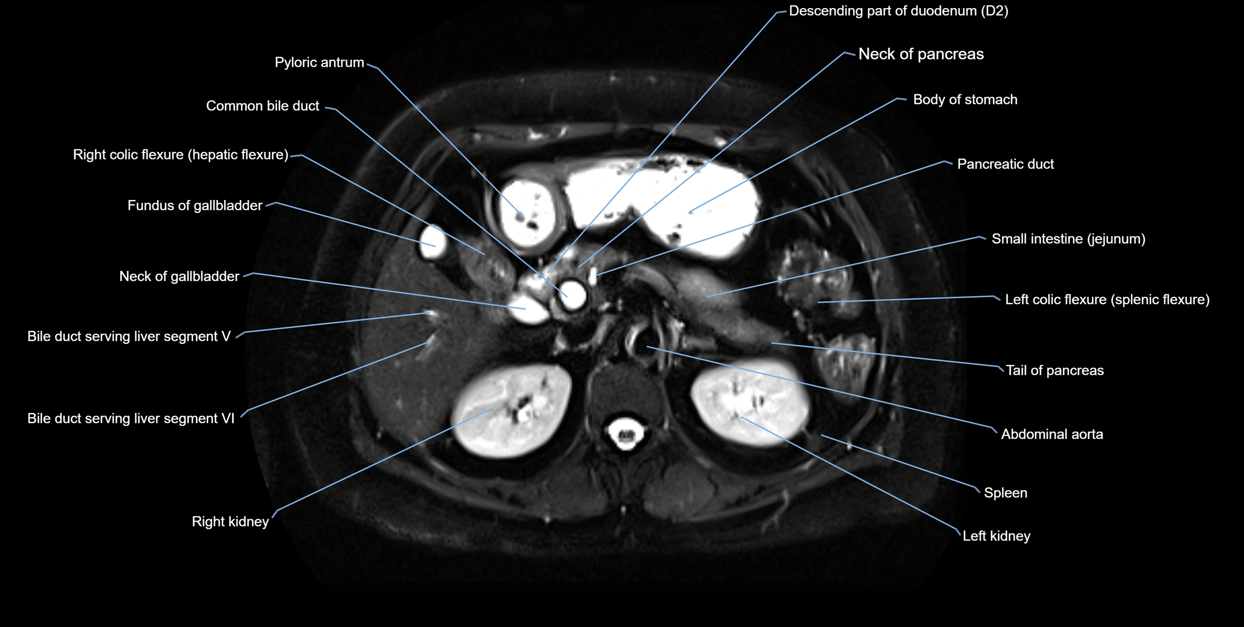 MRI MRCP axial cross sectional anatomy 3T radiology  image-img-10001-00022.webp